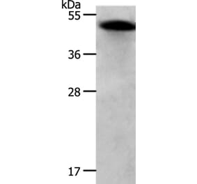 RBMS1 Antibody from Signalway Antibody (37024) - Antibodies.com