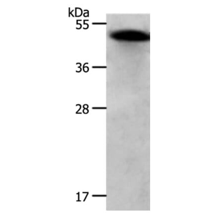 RBMS1 Antibody from Signalway Antibody (37024) - Antibodies.com