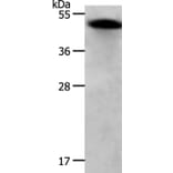 RBMS1 Antibody from Signalway Antibody (37024) - Antibodies.com