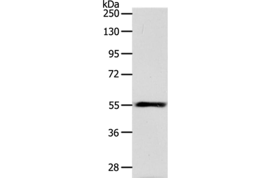 HNF1A Antibody from Signalway Antibody (37049) - Antibodies.com
