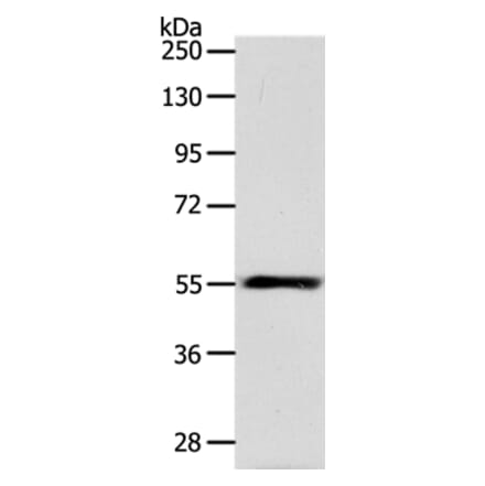 HNF1A Antibody from Signalway Antibody (37049) - Antibodies.com