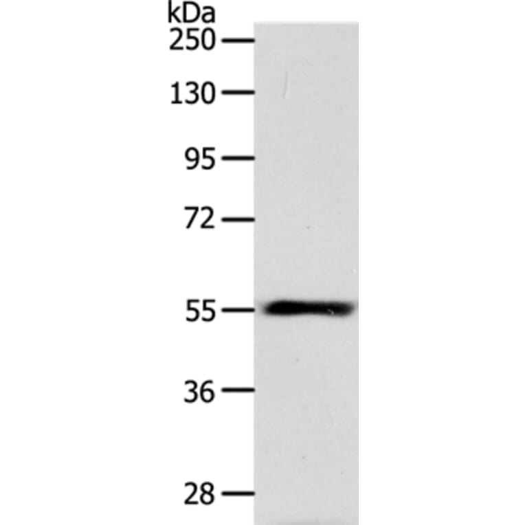 HNF1A Antibody from Signalway Antibody (37049) - Antibodies.com