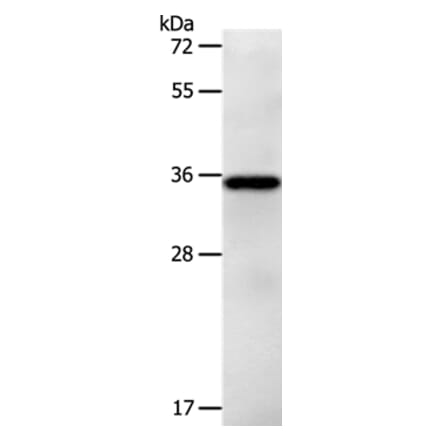 LPPR5 Antibody from Signalway Antibody (37207) - Antibodies.com