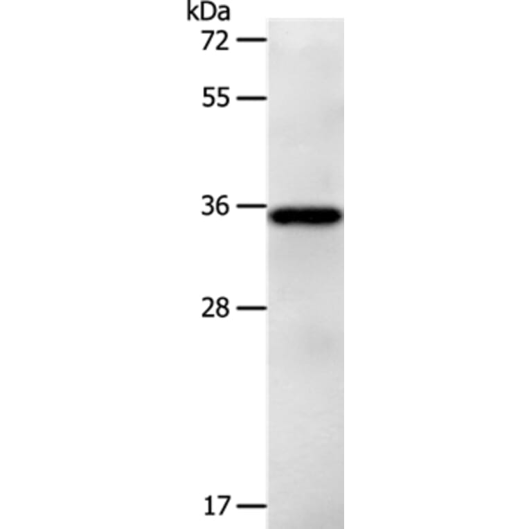 LPPR5 Antibody from Signalway Antibody (37207) - Antibodies.com