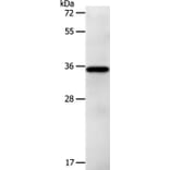 LPPR5 Antibody from Signalway Antibody (37207) - Antibodies.com