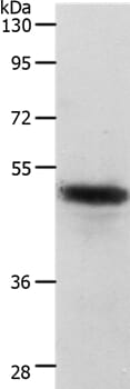 Gel: 10% SDS-PAGE Lysates (from left to right): Human liver cancer tissue Amount of lysate: 40ug per lane Primary antibody: 1/750 dilution Secondary antibody dilution: 1/8000 Exposure time: 40 seconds