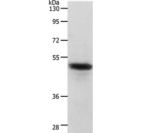 CERS2 Antibody from Signalway Antibody (37286) - Antibodies.com