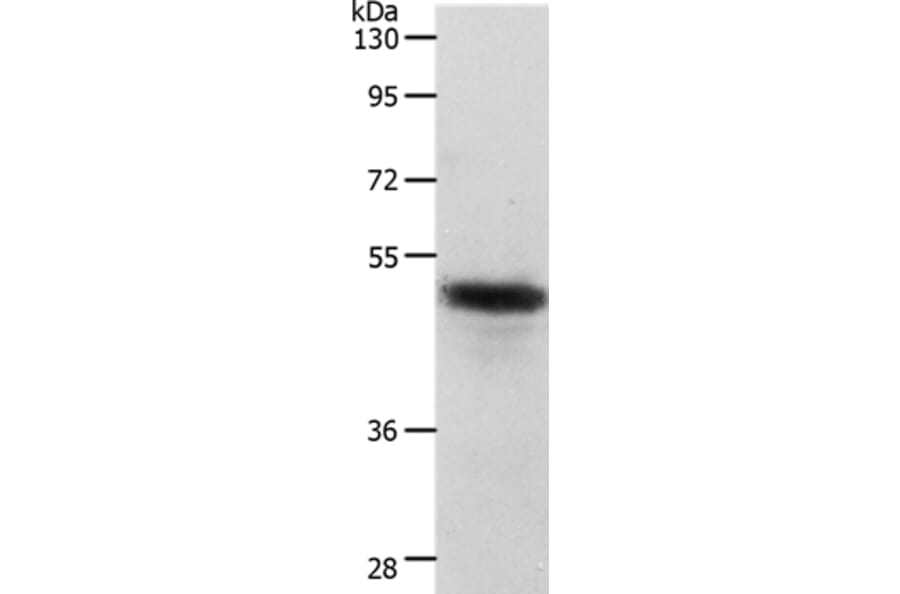CERS2 Antibody from Signalway Antibody (37286) - Antibodies.com