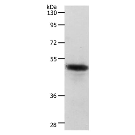 CERS2 Antibody from Signalway Antibody (37286) - Antibodies.com