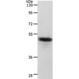 CERS2 Antibody from Signalway Antibody (37286) - Antibodies.com