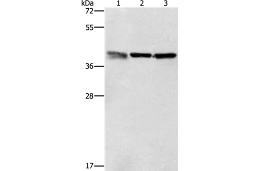 ZFP42 Antibody from Signalway Antibody (37359) - Antibodies.com