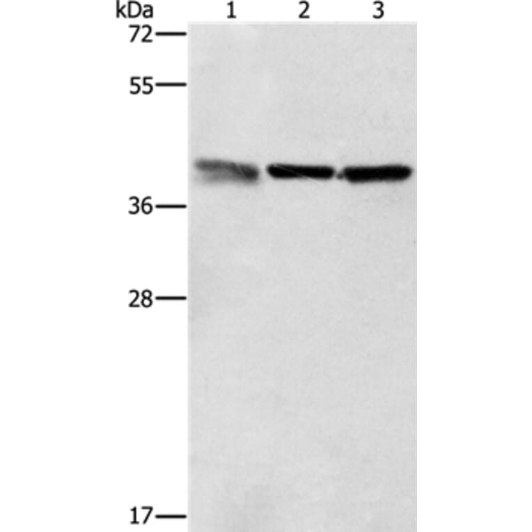 ZFP42 Antibody from Signalway Antibody (37359) - Antibodies.com