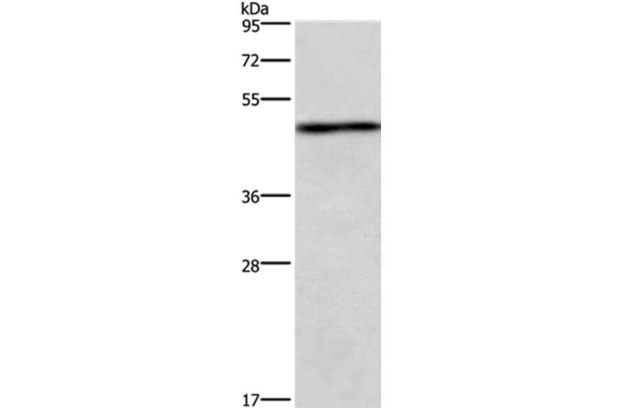 UHMK1 Antibody from Signalway Antibody (37397) - Antibodies.com