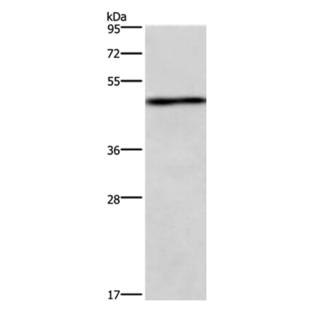 UHMK1 Antibody from Signalway Antibody (37397) - Antibodies.com