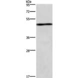 UHMK1 Antibody from Signalway Antibody (37397) - Antibodies.com