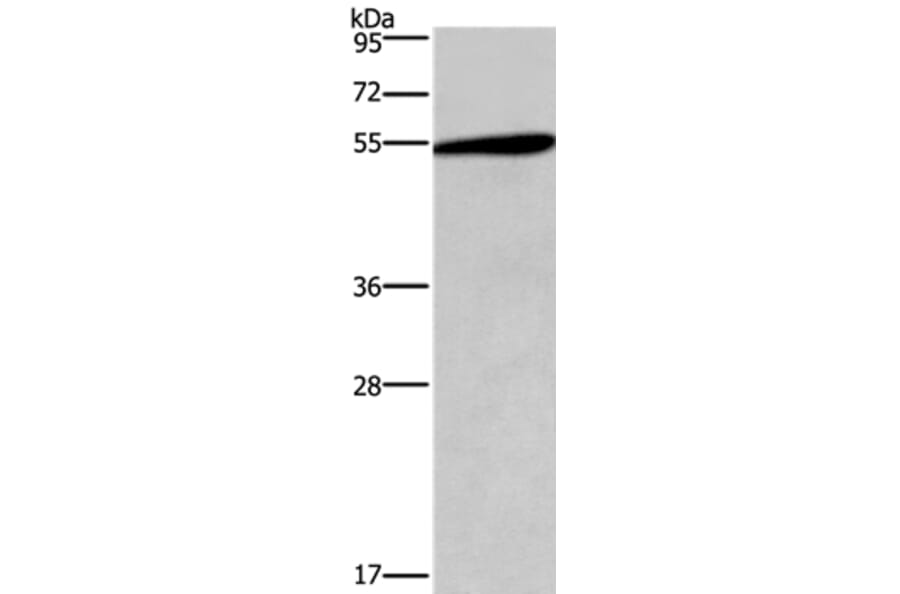 HTR2C Antibody from Signalway Antibody (37404) - Antibodies.com