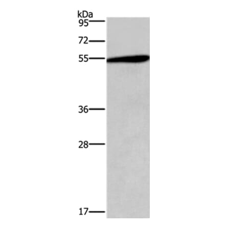 HTR2C Antibody from Signalway Antibody (37404) - Antibodies.com
