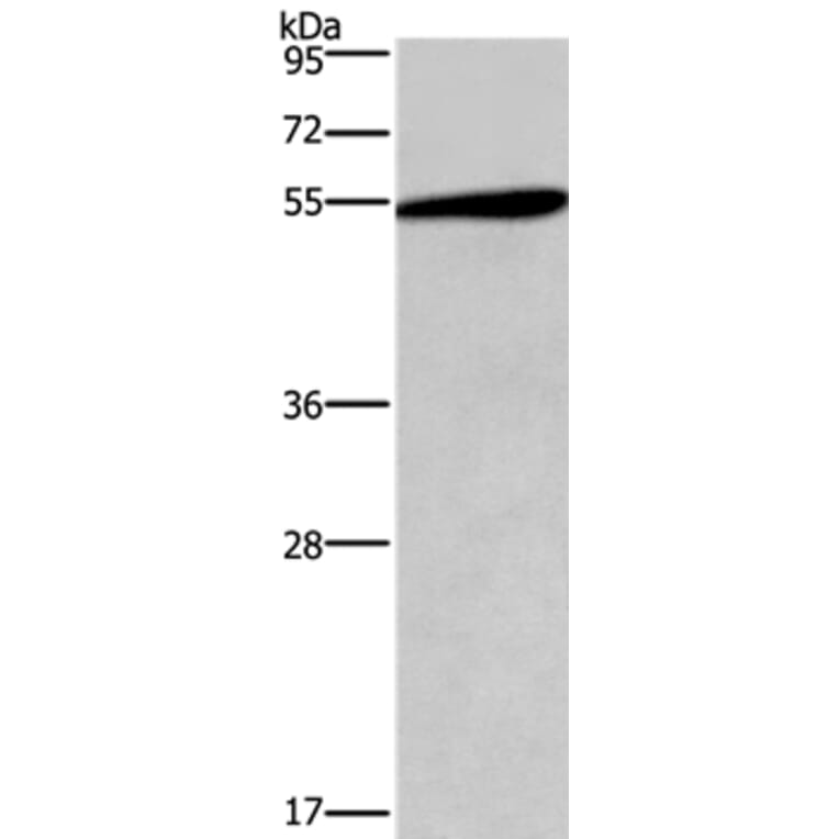 HTR2C Antibody from Signalway Antibody (37404) - Antibodies.com