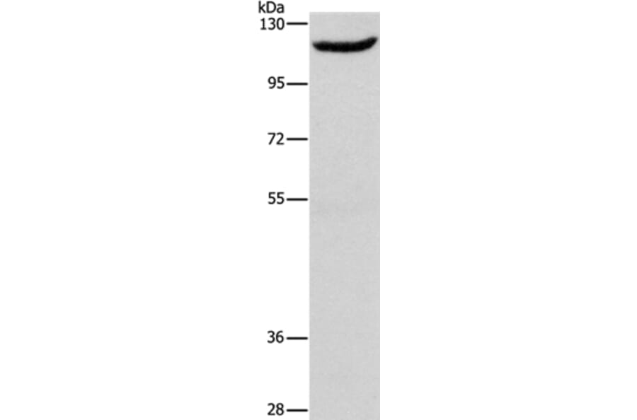 ERAP1 Antibody from Signalway Antibody (37429) - Antibodies.com