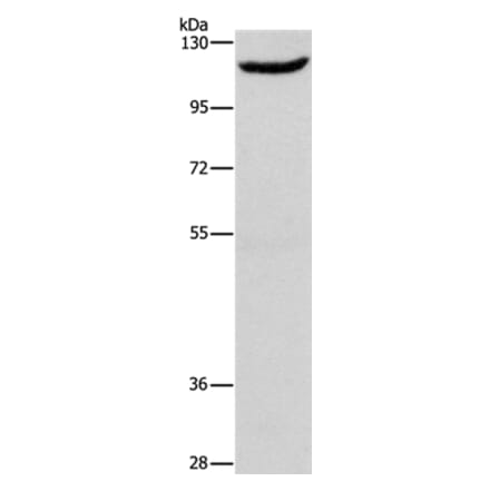 ERAP1 Antibody from Signalway Antibody (37429) - Antibodies.com