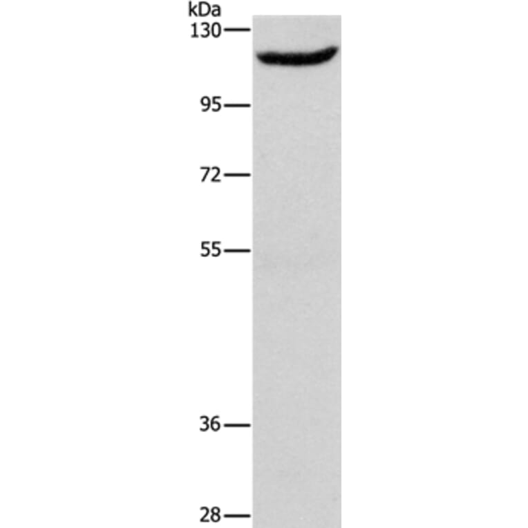 ERAP1 Antibody from Signalway Antibody (37429) - Antibodies.com