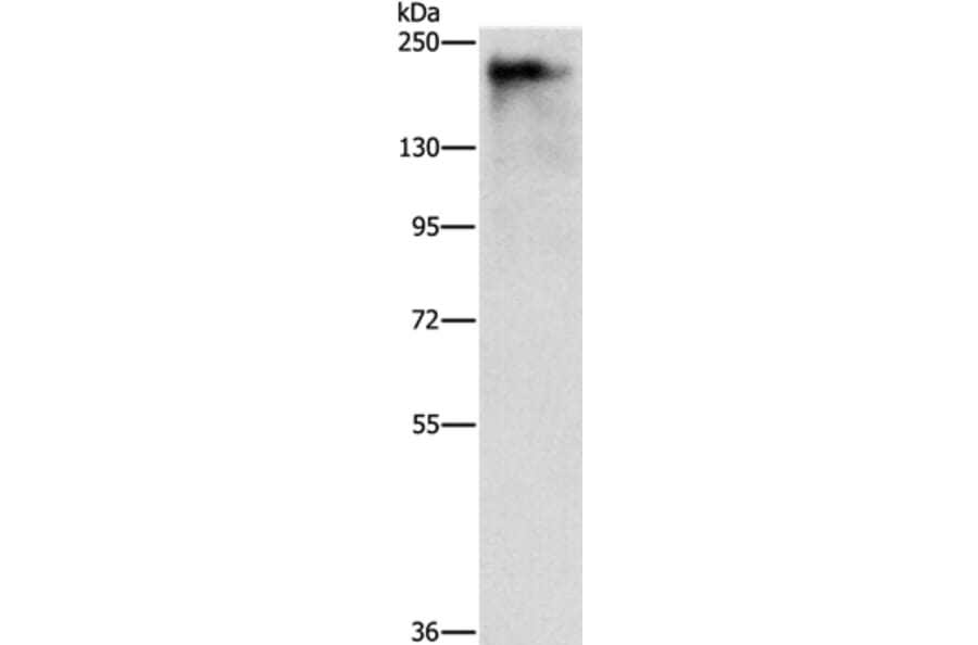 ATAD5 Antibody from Signalway Antibody (37431) - Antibodies.com