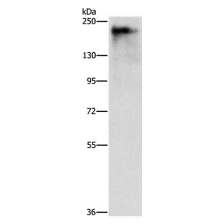 ATAD5 Antibody from Signalway Antibody (37431) - Antibodies.com