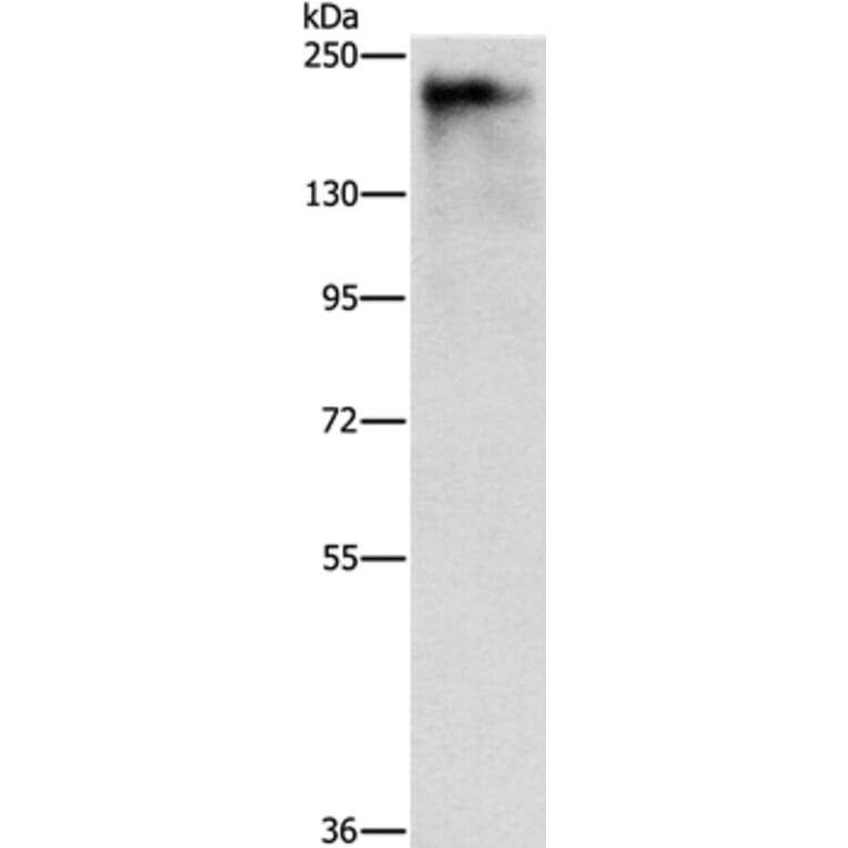 ATAD5 Antibody from Signalway Antibody (37431) - Antibodies.com