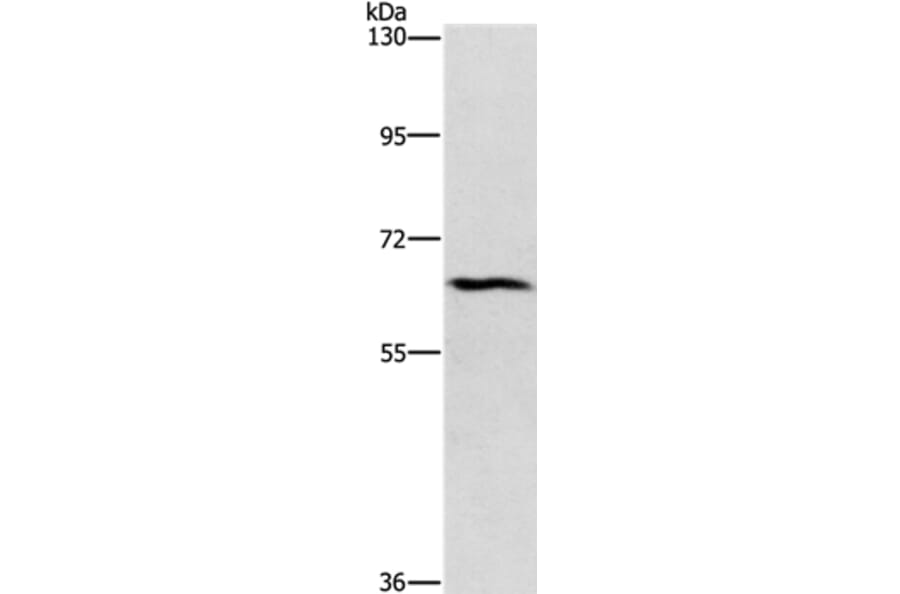 CERKL Antibody from Signalway Antibody (37485) - Antibodies.com