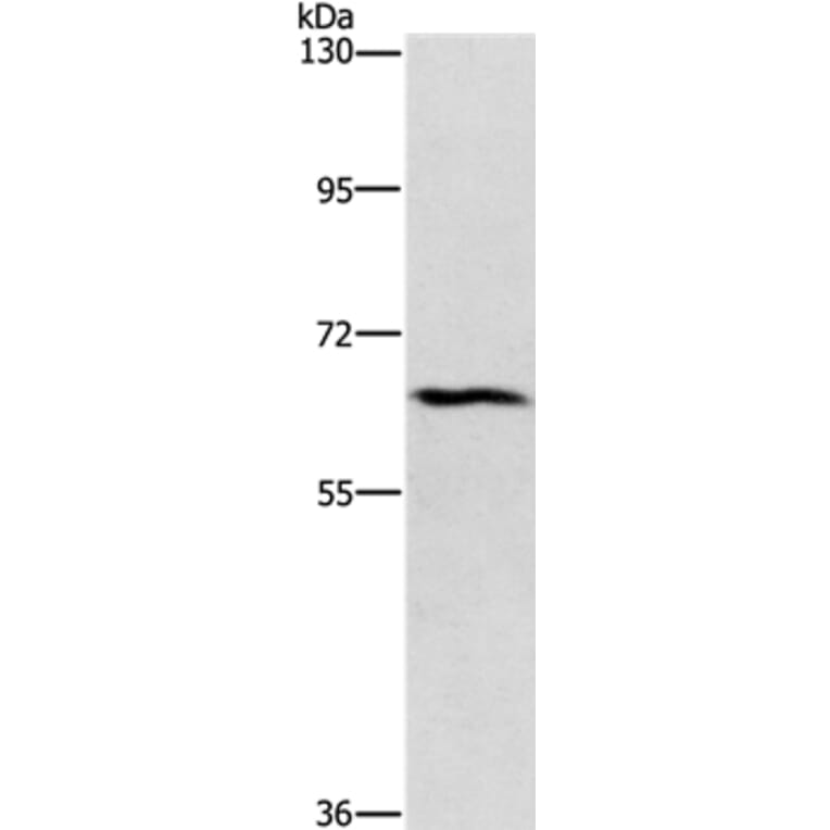 CERKL Antibody from Signalway Antibody (37485) - Antibodies.com