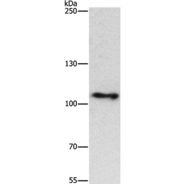 CUL4B Antibody from Signalway Antibody (37513) - Antibodies.com