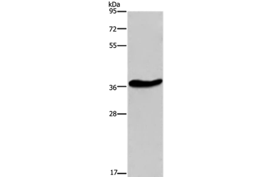 GPR78 Antibody from Signalway Antibody (37609) - Antibodies.com