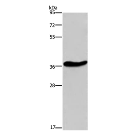 GPR78 Antibody from Signalway Antibody (37609) - Antibodies.com