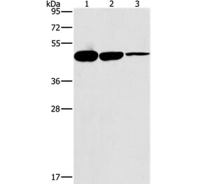 HOXB4 Antibody from Signalway Antibody (37626) - Antibodies.com