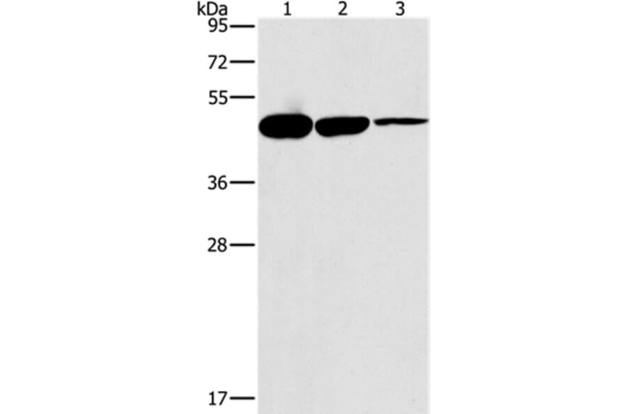 HOXB4 Antibody from Signalway Antibody (37626) - Antibodies.com