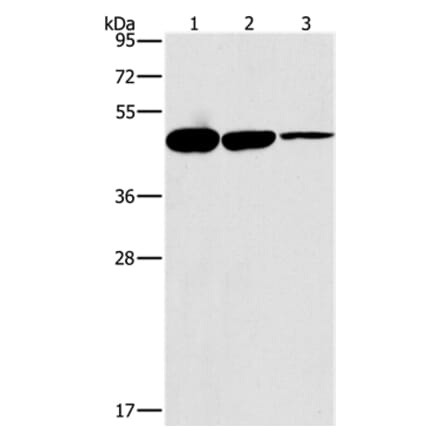 HOXB4 Antibody from Signalway Antibody (37626) - Antibodies.com