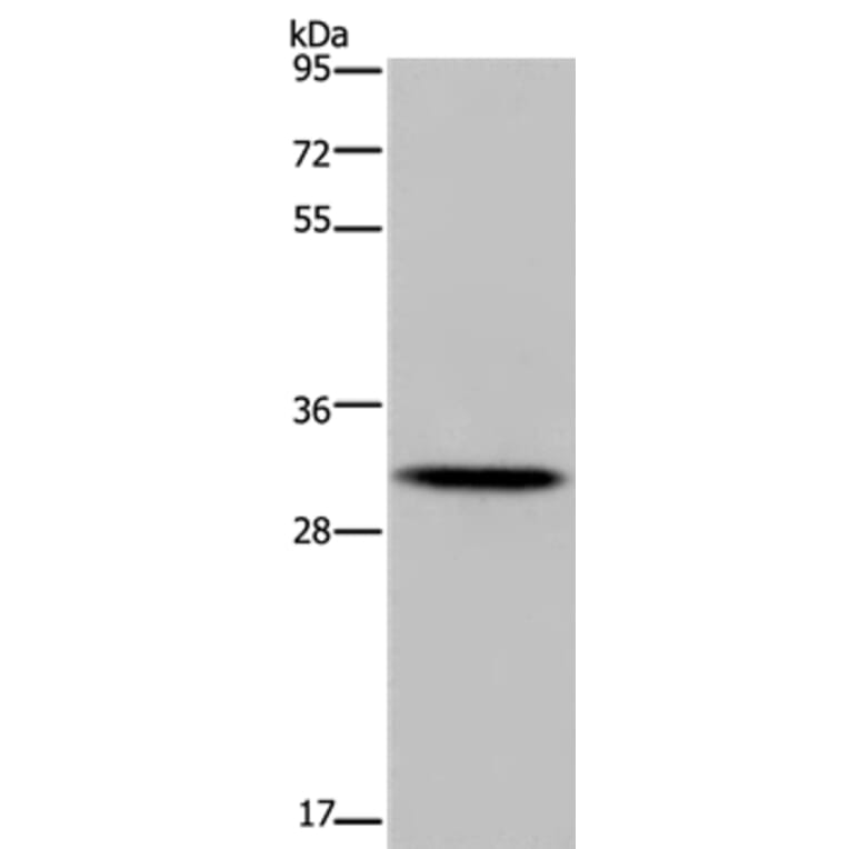 HOXB8 Antibody from Signalway Antibody (37627) - Antibodies.com