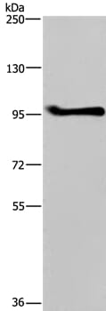 Gel: 6%SDS-PAGE Lysate: 40ug A549 cell Primary antibody: 1/350 dilution Secondary antibody dilution: 1/8000 Exposure time: 20 seconds