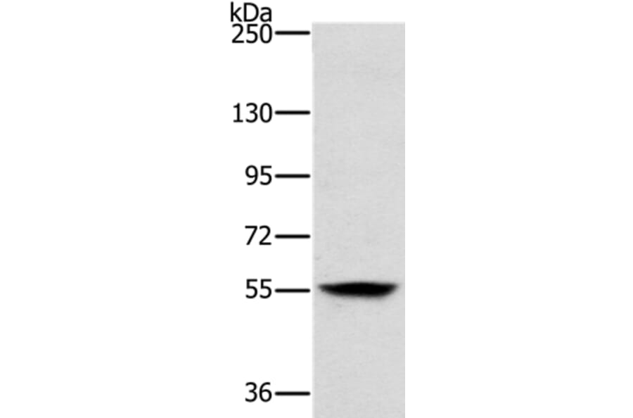 LOXL1 Antibody from Signalway Antibody (37706) - Antibodies.com