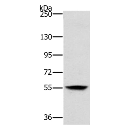 LOXL1 Antibody from Signalway Antibody (37706) - Antibodies.com