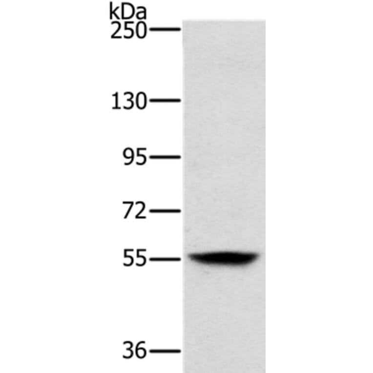 LOXL1 Antibody from Signalway Antibody (37706) - Antibodies.com