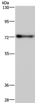 Gel: 6%SDS-PAGE Lysates (from left to right): Mouse brain tissue Amount of lysate: 40ug per lane Primary antibody: 1/250 dilution Secondary antibody dilution: 1/8000 Exposure time: 40 seconds