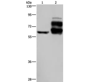 PCSK9 Antibody from Signalway Antibody (37808) - Antibodies.com