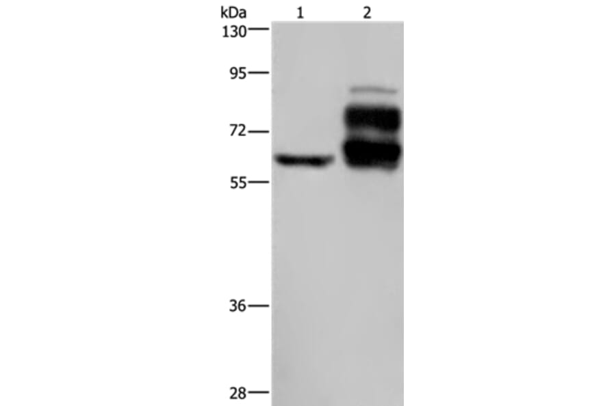 PCSK9 Antibody from Signalway Antibody (37808) - Antibodies.com