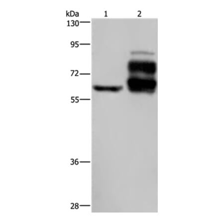 PCSK9 Antibody from Signalway Antibody (37808) - Antibodies.com