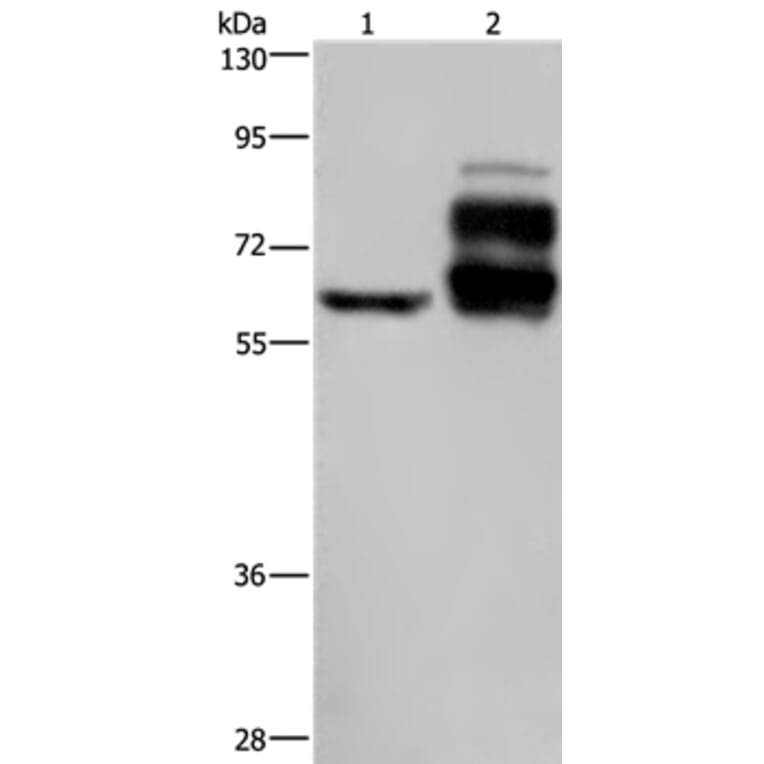 PCSK9 Antibody from Signalway Antibody (37808) - Antibodies.com