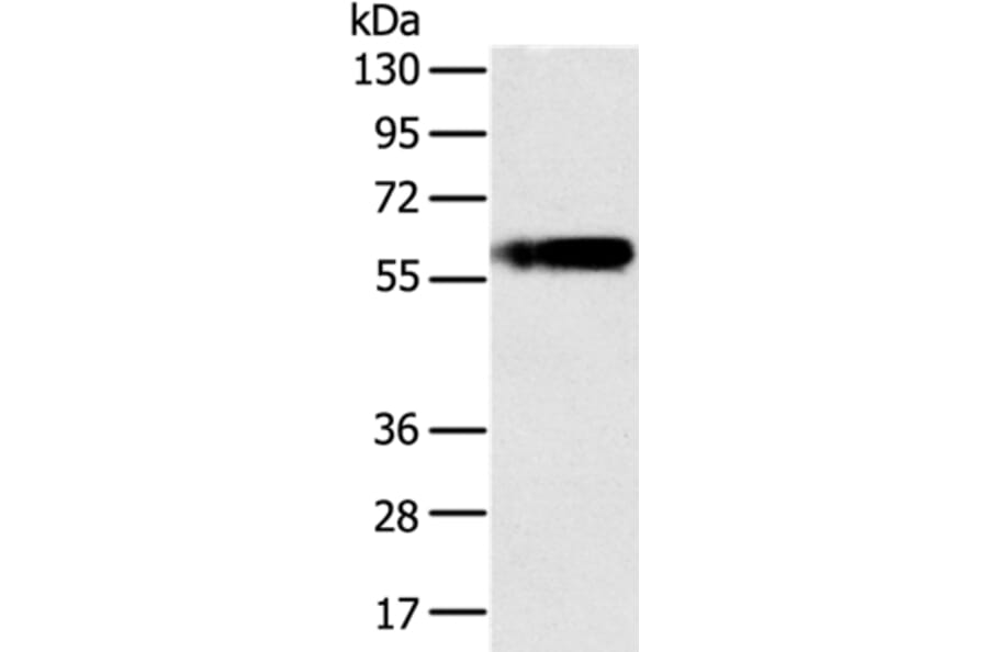 PLIN1 Antibody from Signalway Antibody (37815) - Antibodies.com