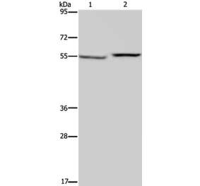 PHGDH Antibody from Signalway Antibody (37821) - Antibodies.com