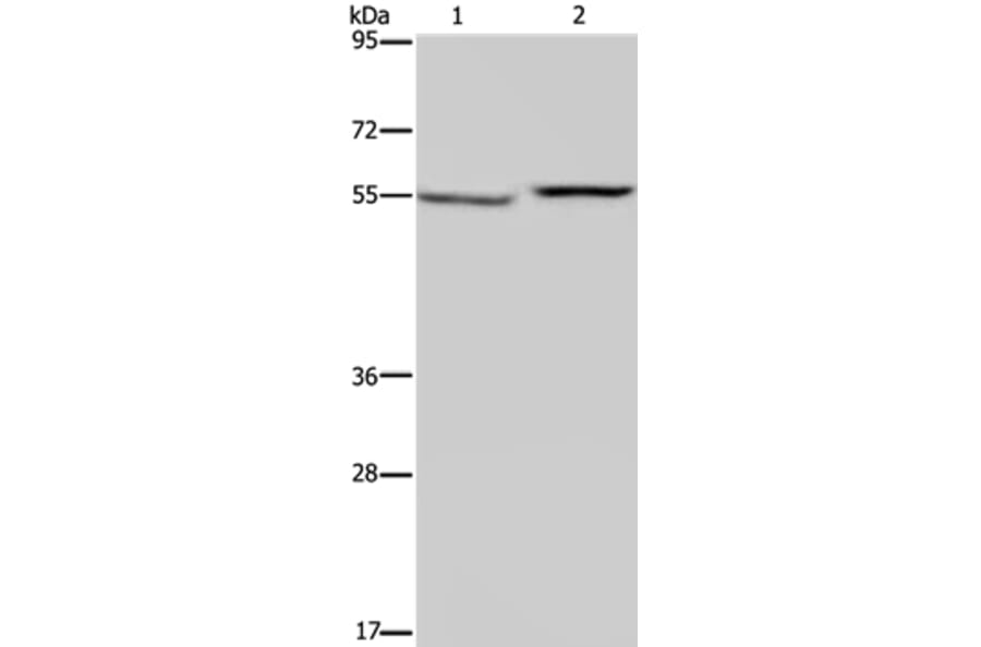 PHGDH Antibody from Signalway Antibody (37821) - Antibodies.com