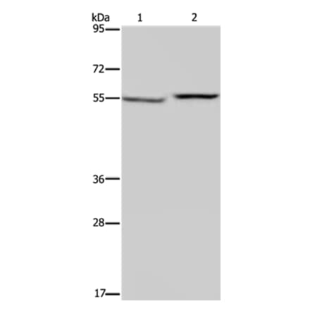 PHGDH Antibody from Signalway Antibody (37821) - Antibodies.com